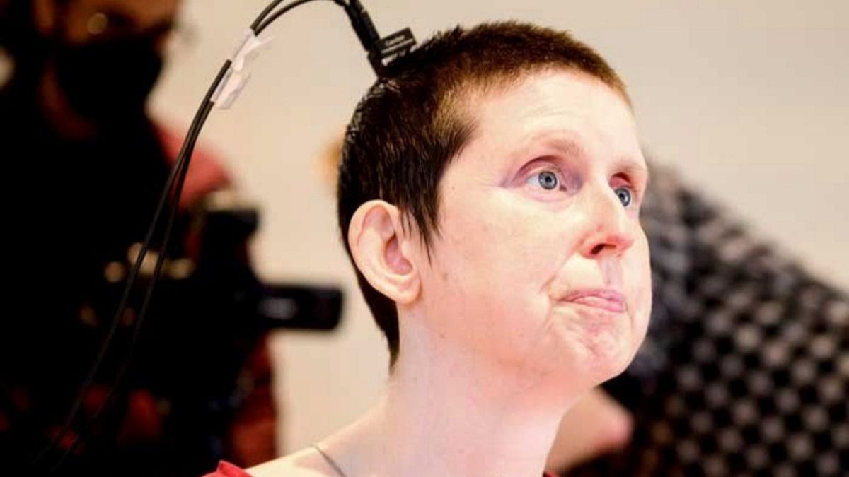 Deneysel beyin-bilgisayar implantı, felçli hastanın konuşmasına yardımcı oldu